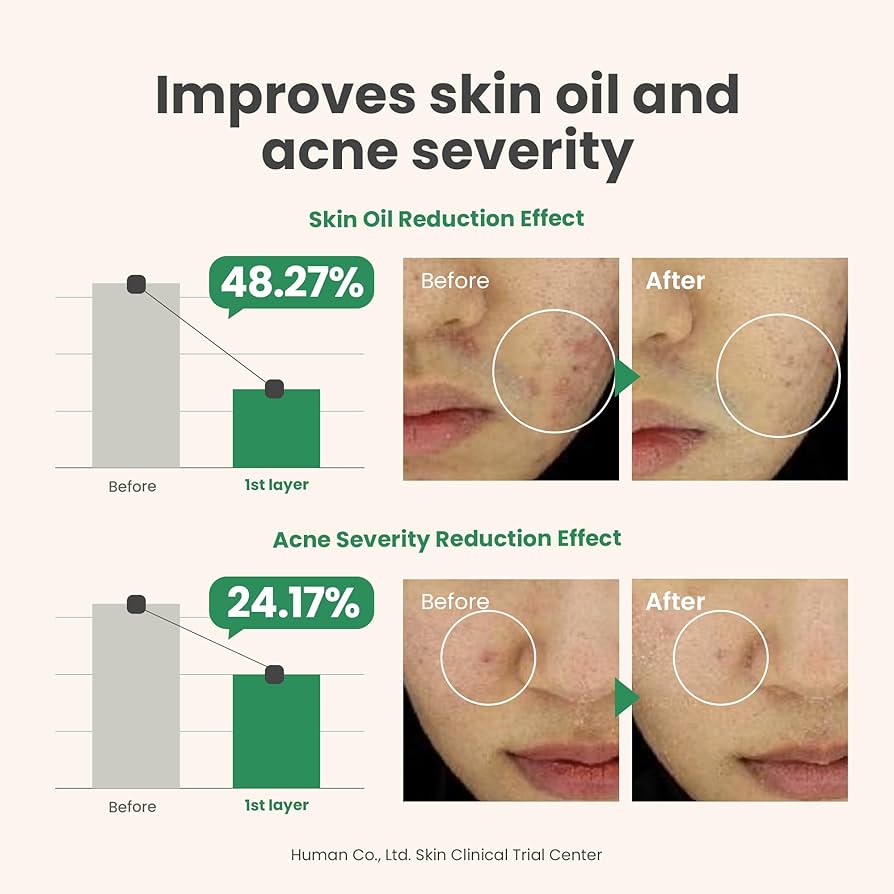 AXIS-Y Spot the Difference Blemish Treatment - 15ml Hanyori Skin