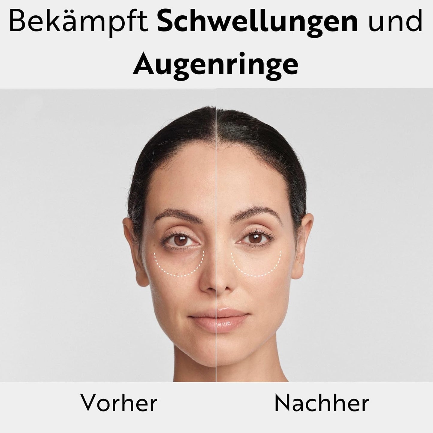 M. Asam Magic Care Perfect Eye Augenserum (25 ml) | Gegen dunkle Augenringe & Schwellungen, mit 360° Straffungseffekt & Hyaluronsäure