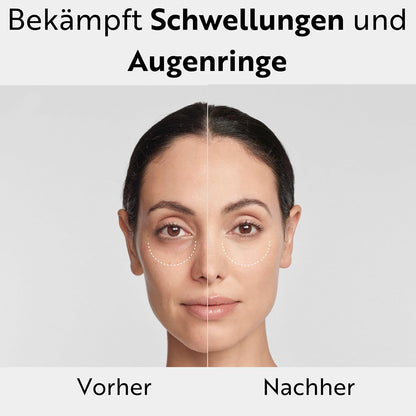M. Asam Magic Care Perfect Eye Augenserum (25 ml) | Gegen dunkle Augenringe & Schwellungen, mit 360° Straffungseffekt & Hyaluronsäure