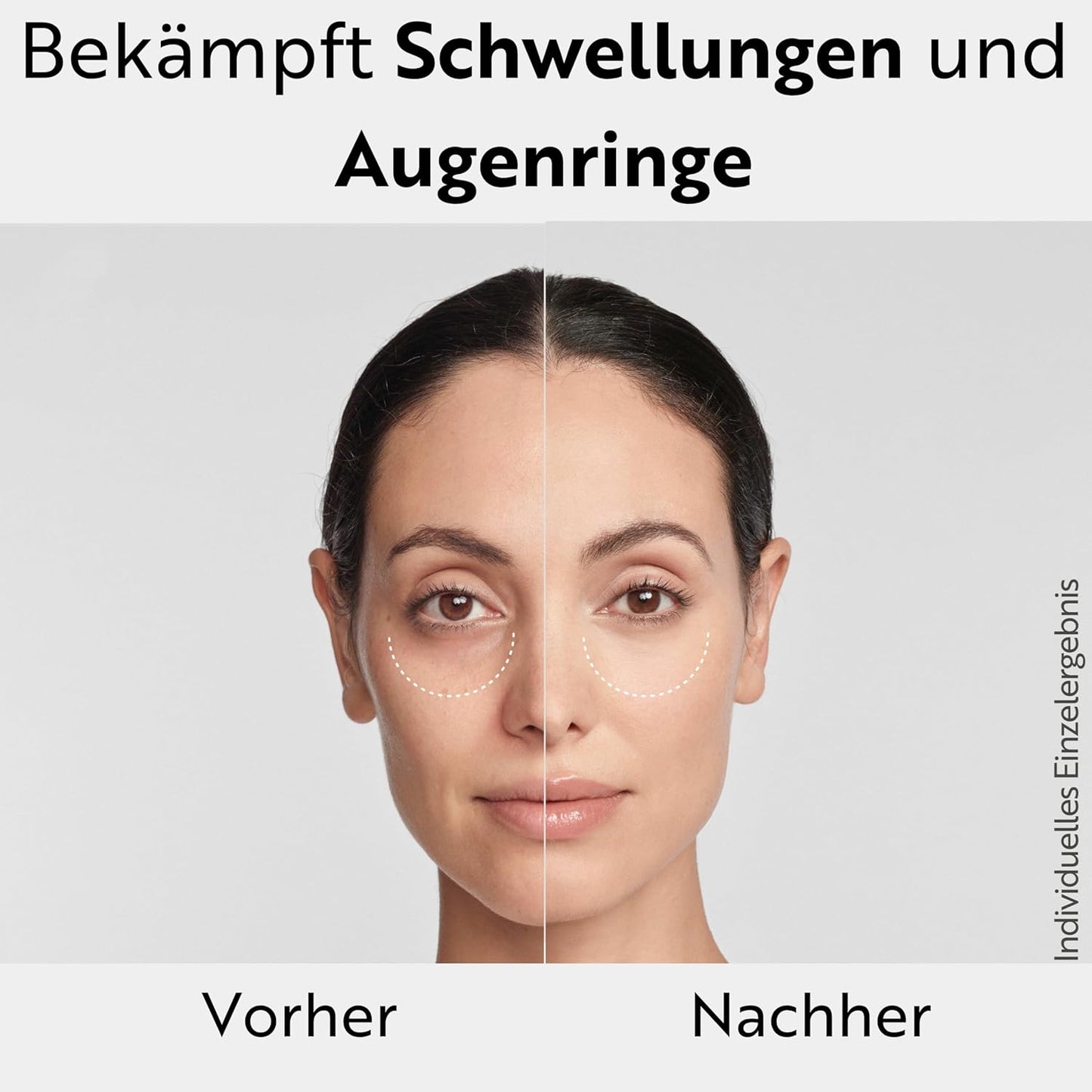 M. Asam Magic Care Perfect Eye Augenserum (25 ml) | Gegen dunkle Augenringe & Schwellungen, mit 360° Straffungseffekt & Hyaluronsäure
