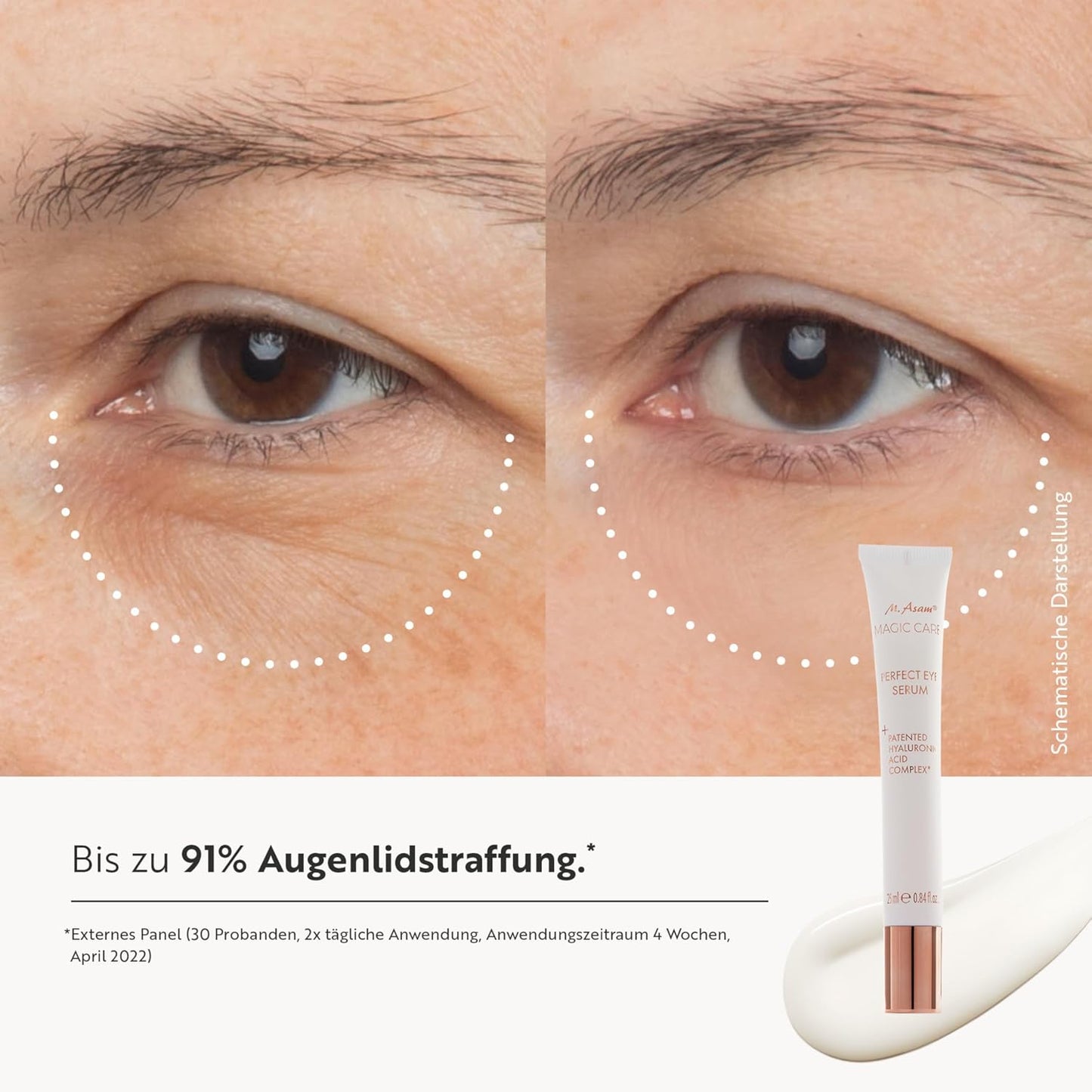 M. Asam Magic Care Perfect Eye Augenserum (25 ml) | Gegen dunkle Augenringe & Schwellungen, mit 360° Straffungseffekt & Hyaluronsäure