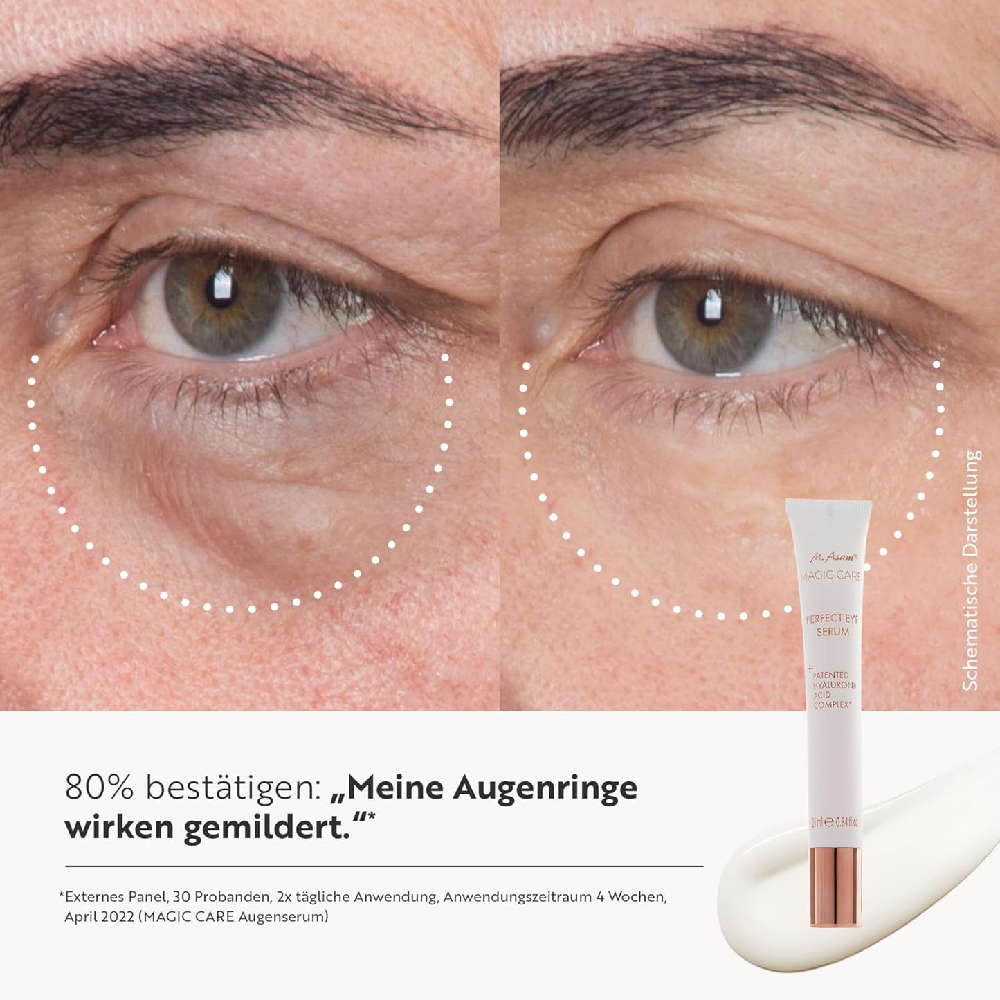 M. Asam Magic Care Perfect Eye Augenserum (25 ml) | Gegen dunkle Augenringe & Schwellungen, mit 360° Straffungseffekt & Hyaluronsäure