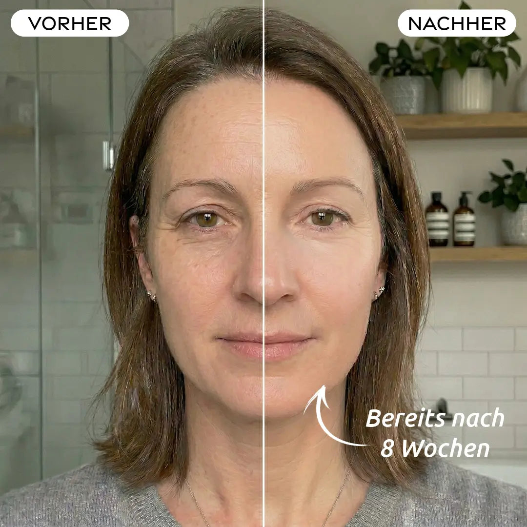 LED Lichttherapie Maske Purenin