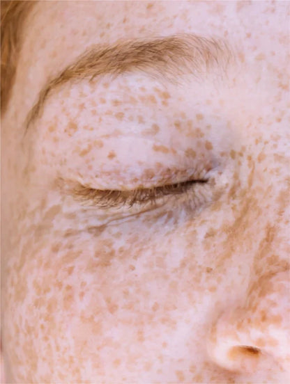 Vitamin C Serum Lamidibeauty