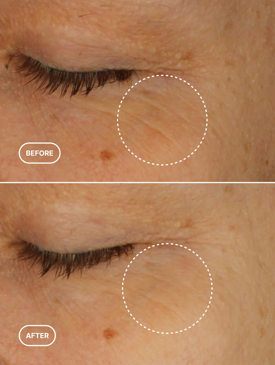 Retinol Alternative Eye Serum Lamidibeauty