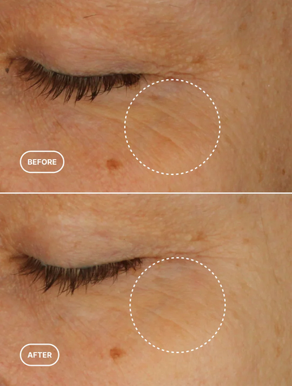 Retinol Alternative Eye Serum Lamidibeauty
