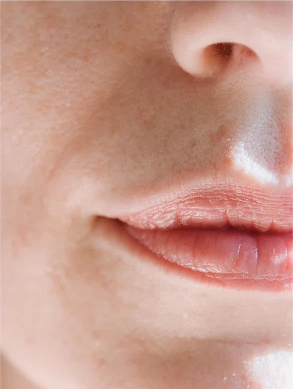 Soft Skin Balance Lamidibeauty
