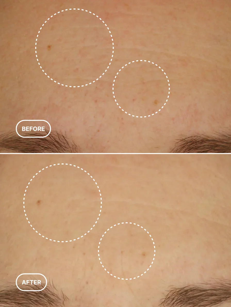 Retinol Alternative Moisturiser Lamidibeauty