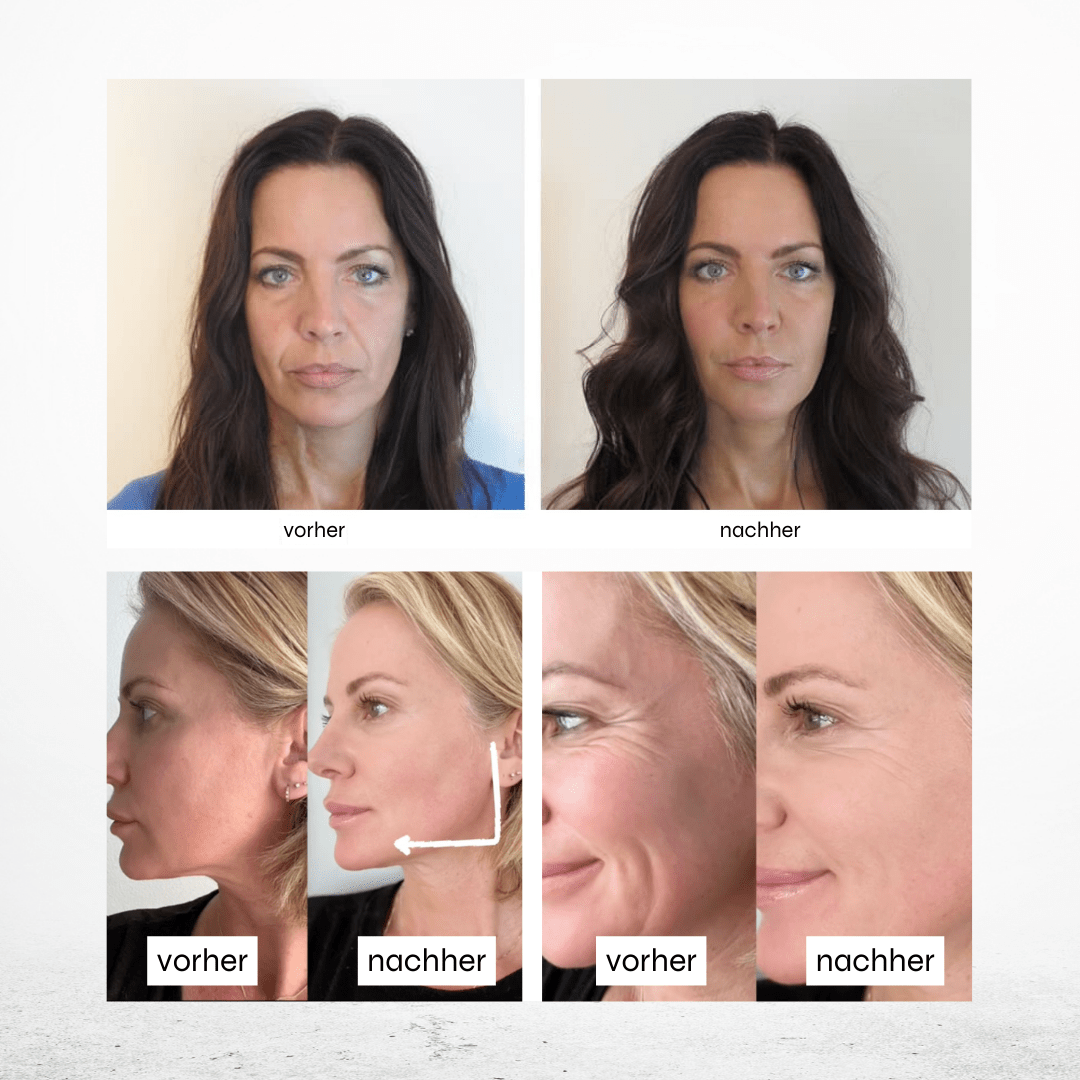 Hyaluron Maske •Anti Age• mit Lotusextrakt Pure Elements Naturkosmetik